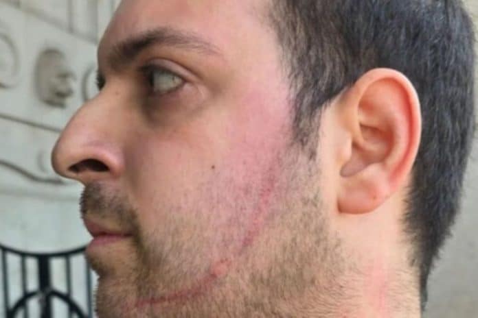 Državljanke BiH napale predsjednika Komiteta za bezbjednost Milana