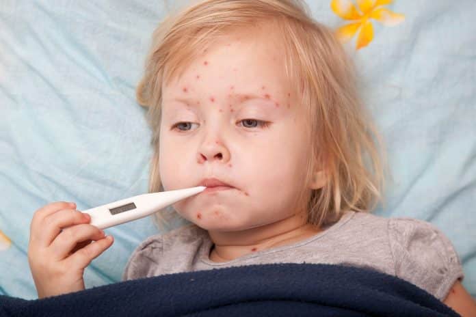 Prikaz trenutne situacije epidemije morbila u ZDK-u