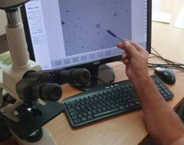 Zenica: Izvještaj o ispitivanju alergenog polena u zraku od 16.06.