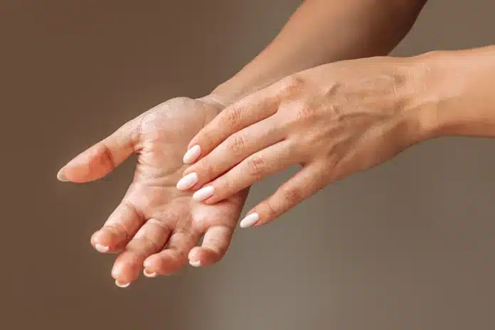 Znojite li često dlanove? Otkrijte učinkovite metode za trajno rješenje