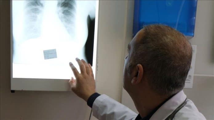 Najsmrtonosniji karcinom sve veća opasnost i u BiH: Blizu dva